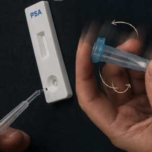 Test spécifique de détection de sperme – Analyse PSA ciblée